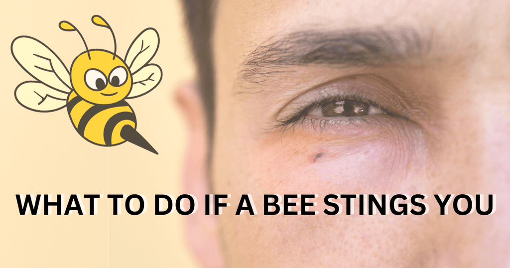What to Do If a Beekeeper Gets Stung? Guide to Bee Sting First Aid.